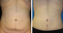 Before & After Photos
